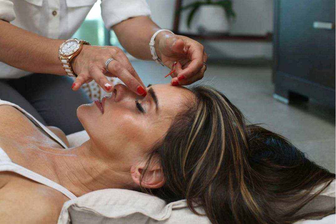 Microneedling